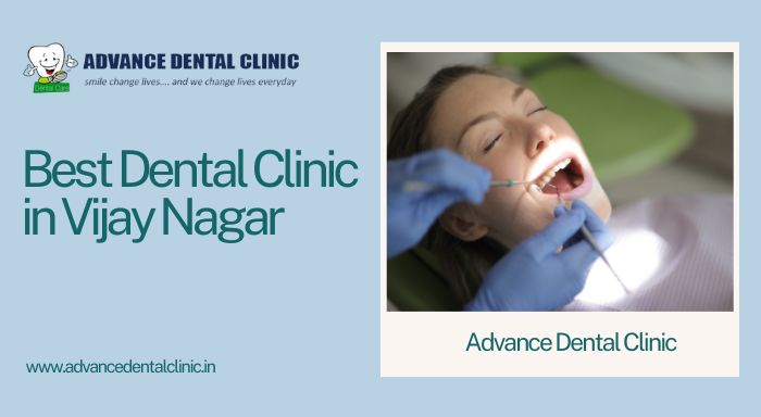 Best Dental Clinic In Vijay Nagar